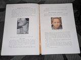Skin and Sexual Diseases Book 1940
