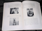 Skin and Sexual Diseases Book 1940